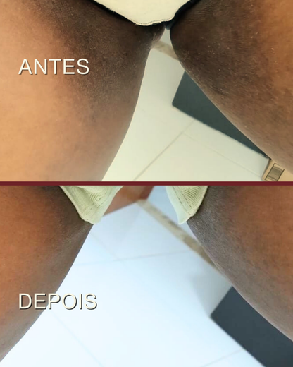 Regulador de Melanina + Hidratante Potencializador Antimanchas