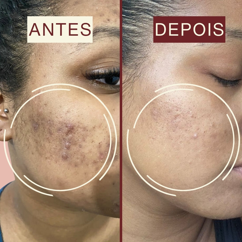 Uniformizador Multifuncional Avançado